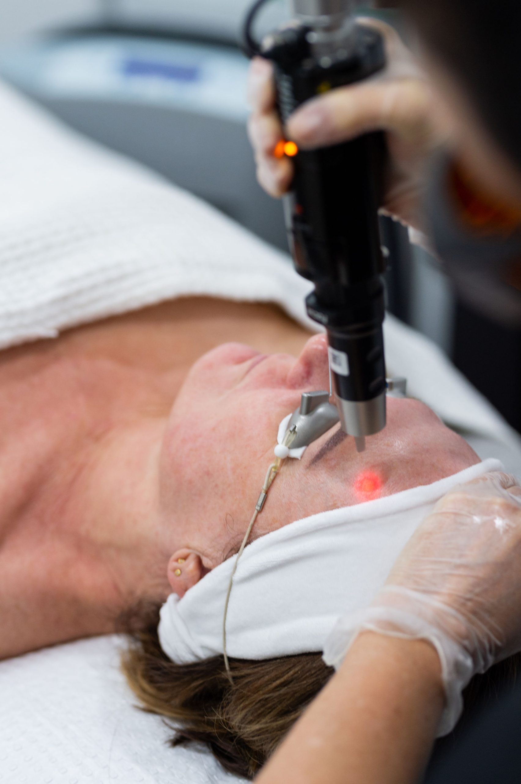 PicoSure Laser Facial Treatments Laser Skin Centre