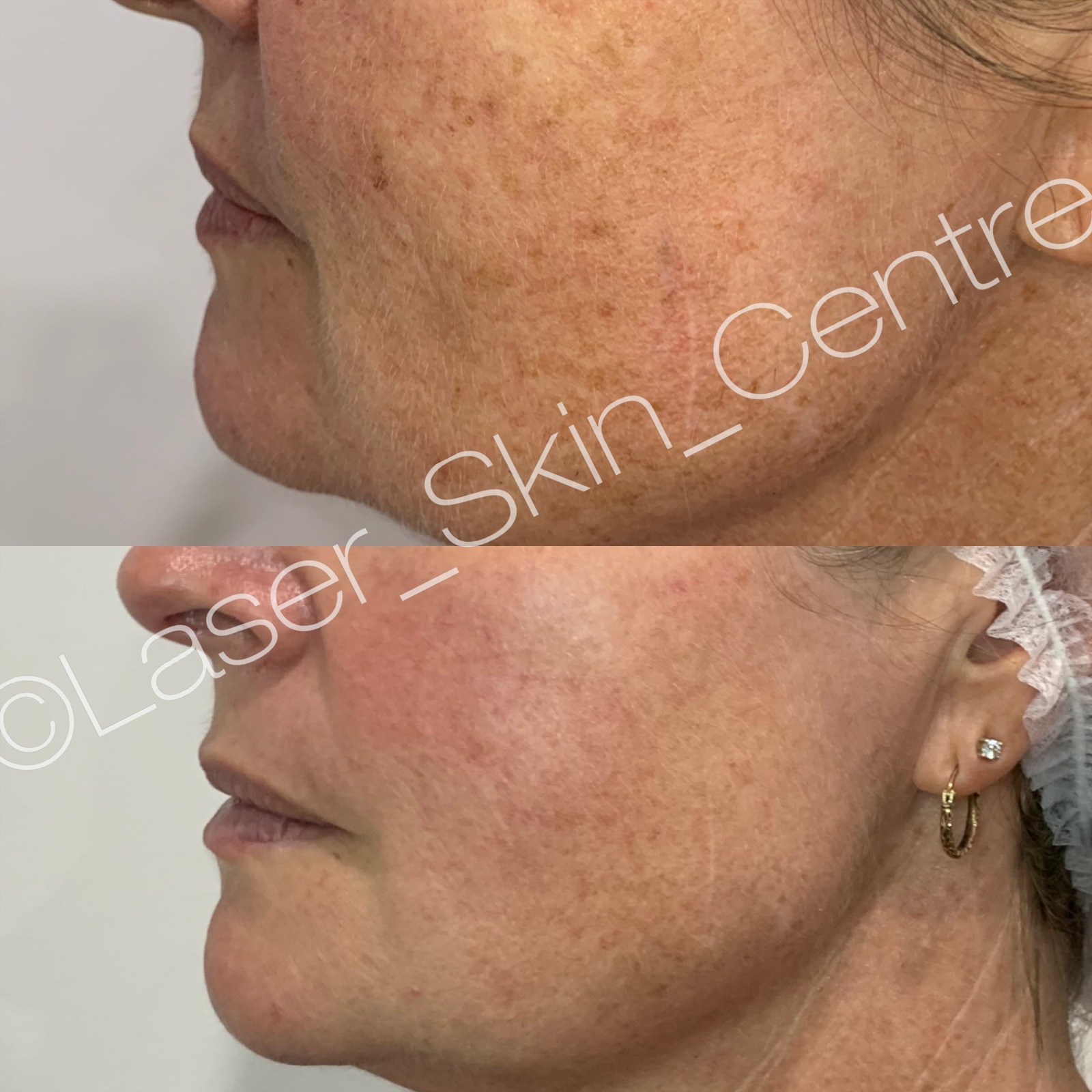 eZy Watermark_05-10-2021_01-20-38pm