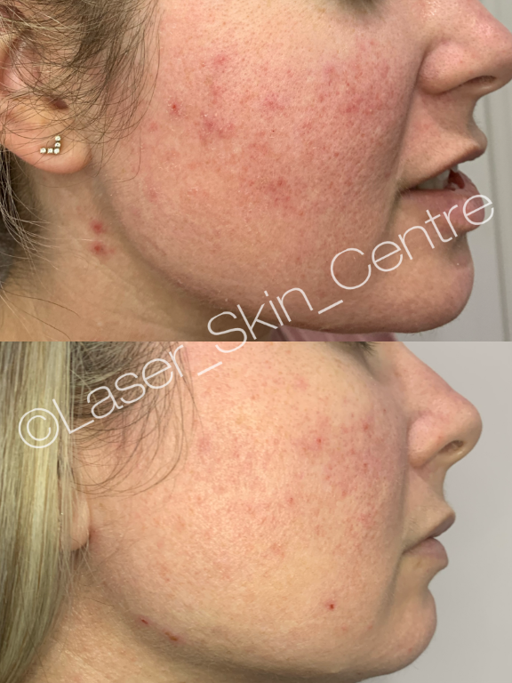 eZy Watermark_23-04-2021_10-28-39am