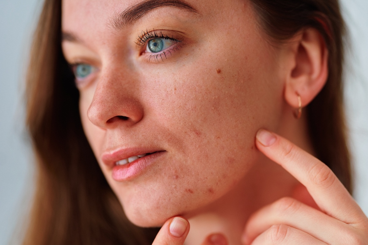 ✨ THE CLEAR & CALM LASER GENESIS PLAN